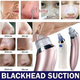 XN-8030 Facial Blackhead Cleanser Vacuum Suction